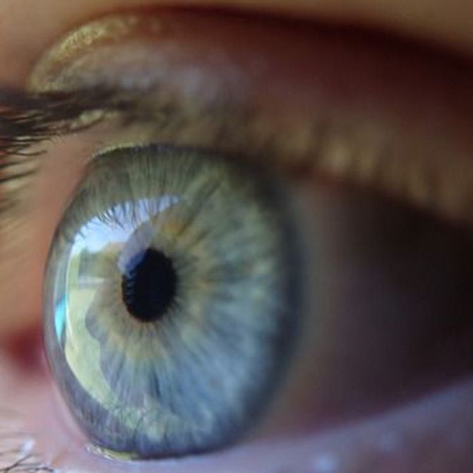 ¿Qué diferencia hay entre miopía y astigmatismo?