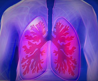 Cáncer de pulmón: Neumología de José  María  Ignacio Garcia