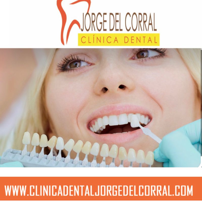 Revisión dental Hortaleza Canillas Madrid