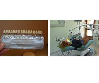 Estética dental: Especialidades de Clínica Dental Dres. Carrasco y García