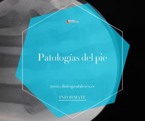 Clínica de podología en Barcelona | Podoherco