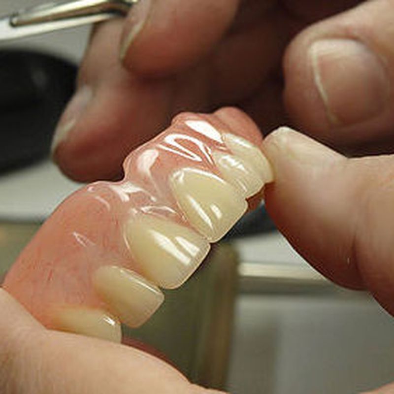 Prótesis : Tratamientos   de Abad Clínica Dental