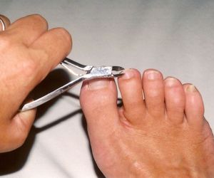Tratamiento de enfermedades del pie