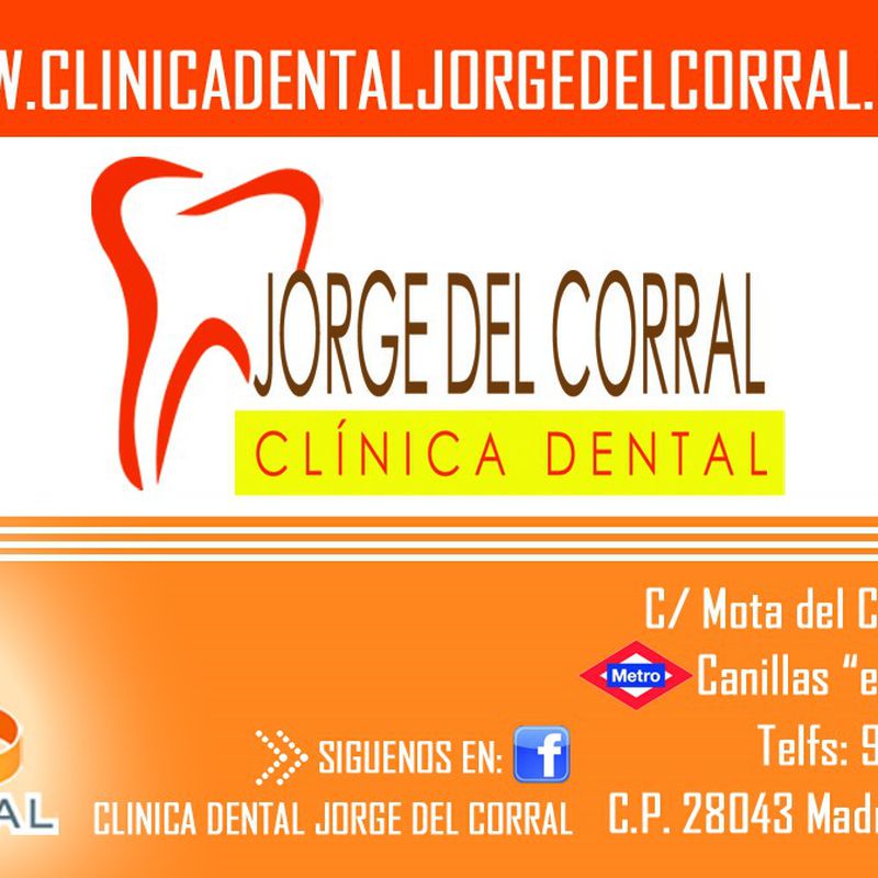 Estética dental-carillas dentales Hortaleza-Canillas