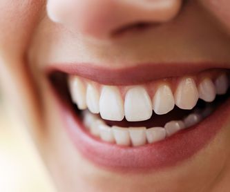 Ortodoncia: Tratamientos y Servicios de Clínica Dental Censadent