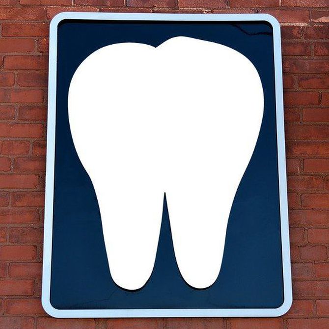 Consejos para mantener, por mucho tiempo, tus implantes dentales