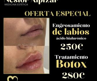 Mesoterapia facial / Vitaminas: Tratamientos de estética de Clínica Estética Loveliness