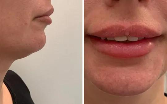 Imagen 7 de la galería