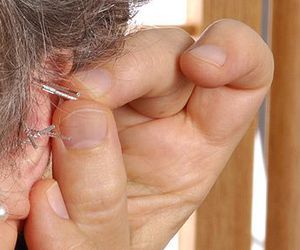 Los beneficios y usos la acupuntura