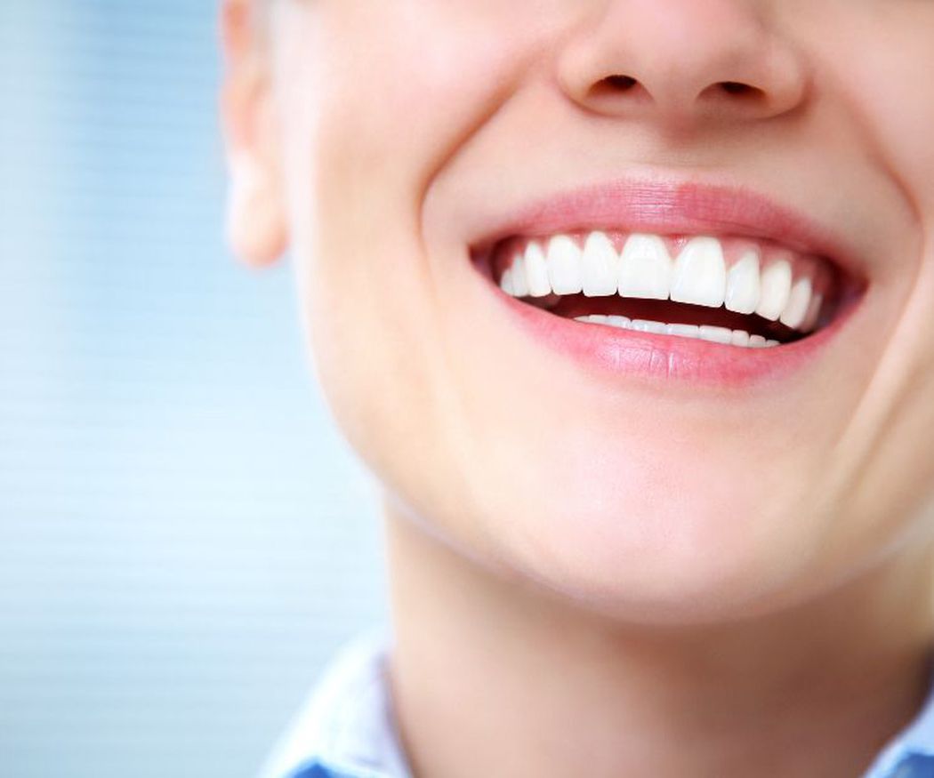 ¿Qué ventajas tienen los blanqueamientos dentales?