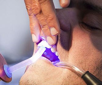 Blanqueamiento dental: Tratamientos de Clínica Dental Palamadent