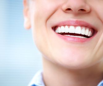 Limpieza bucal: Servicios  de Clínica Dental Cadillon