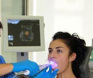 Escaneado de modelos dentales