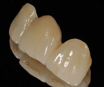 Blanqueamientos dentales: Tratamientos dentales de Clínica Dental Dres. Nuñez García
