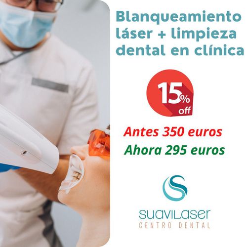 Implantes dentales Madrid Centro