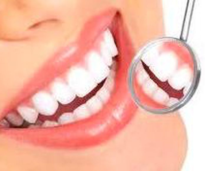Estética Dental: Tratamientos de CLIESDENT - Clínica de Especialistas Dentales }}