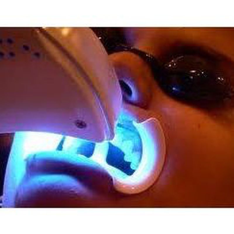 Blanqueamiento dental: Tratamientos de Pies y Manos
