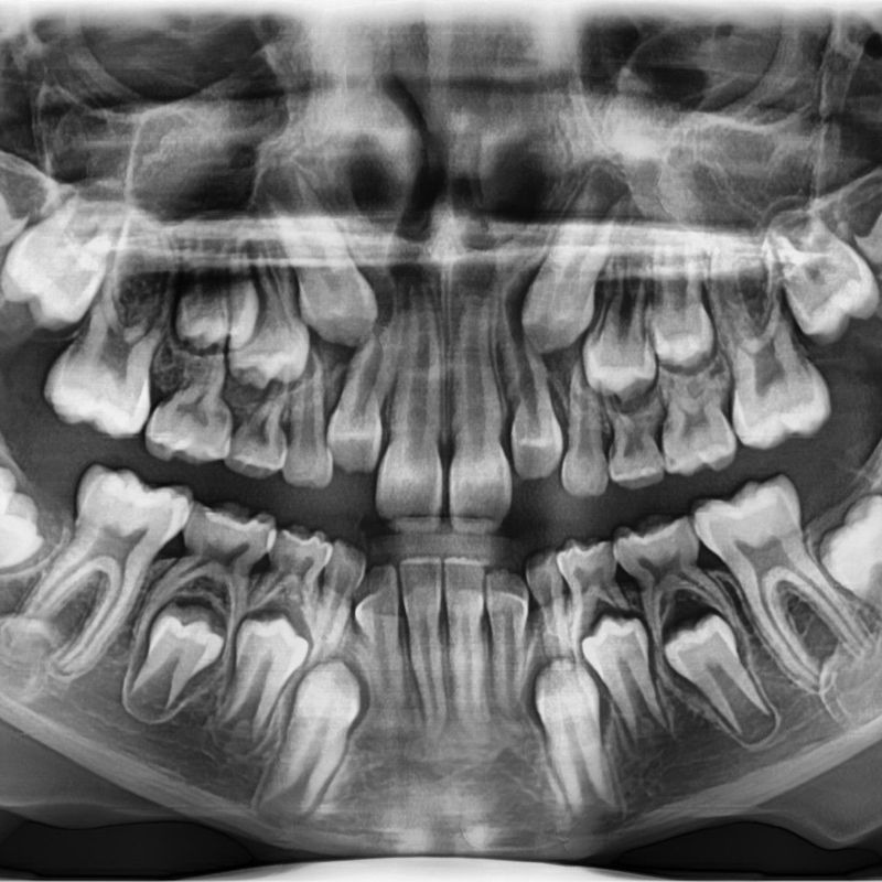 Radiología panorámica: Especialidades odontológicas de Clínica Dental Gil Nieto