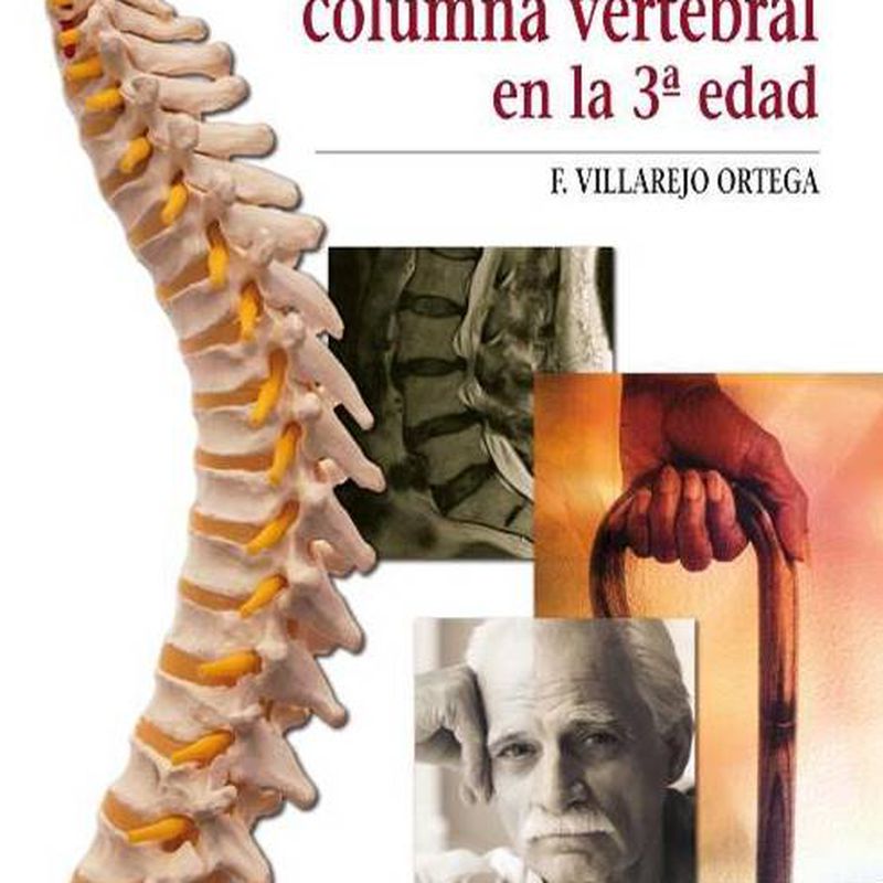 PATOLOGÍA DE LA COLUMNA VERTEBRAL EN LA TERCERA EDAD F. VILLAREJO ORTEGA