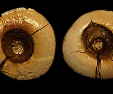 ¿Sabías que... el empaste dental más antiguo fue hecho con plantas hace 13.000 años?
