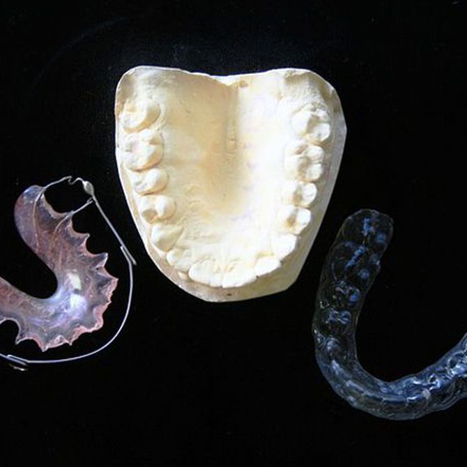 Ortodoncia invisible, todo ventajas