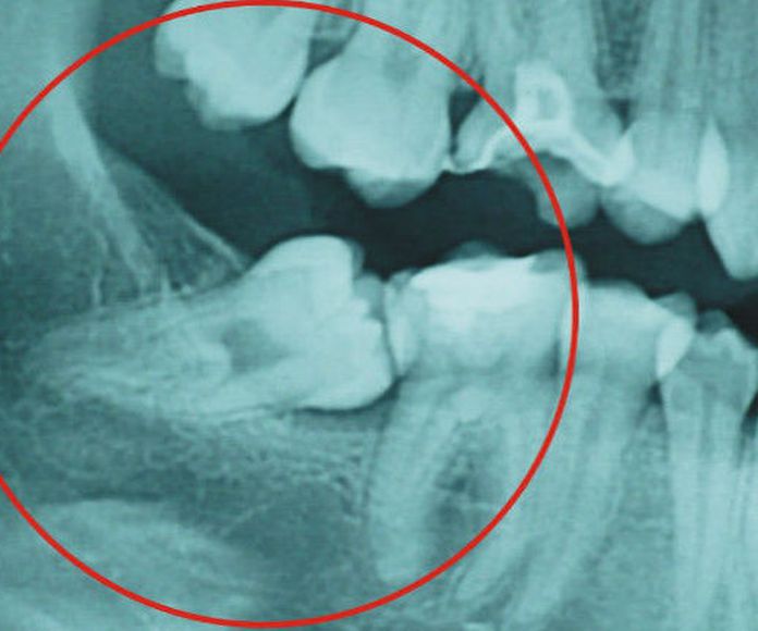 Radiografias: Servicios de Clínica Dental Flordent