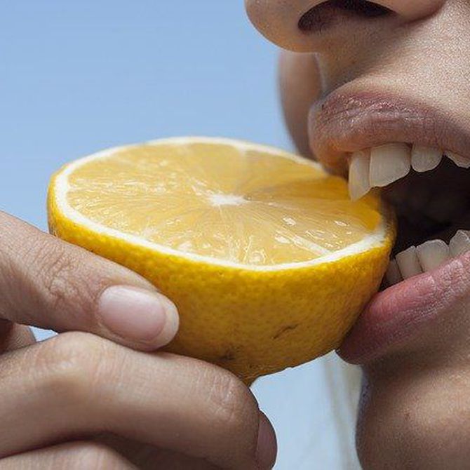 ¿Qué alimentos se deben evitar después de un tratamiento de blanqueamiento dental?