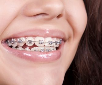 Brackets metálicos: Ortodoncia de Isabel Perales Clínica Dental