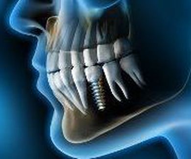 Dentistas en Madrid - Clinicas dentales en Madrid.