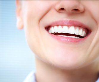 Blanqueamiento dental: SERVICIOS de Altes Dental