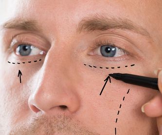 Medicina estética facial: Servicios de Clínica Libreros Medicina Estética