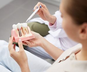 La importancia de los implantes dentales