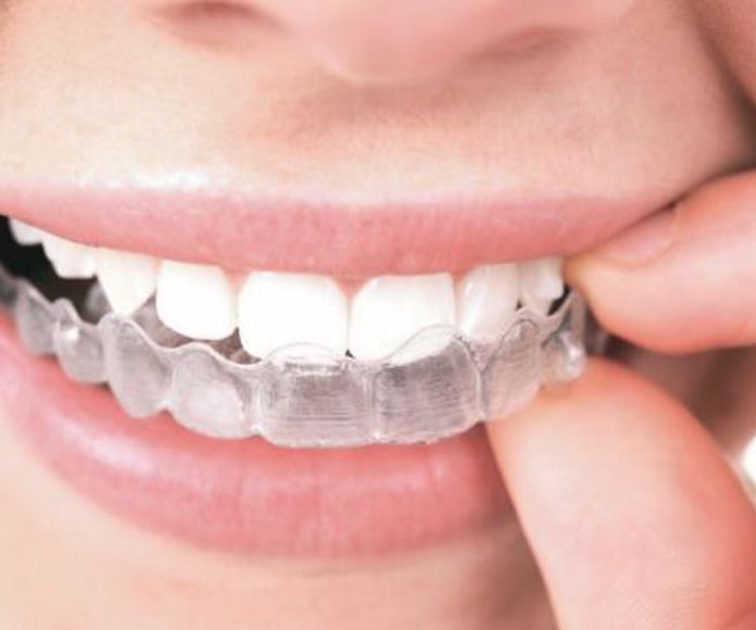 Ortodoncia: Servicios de Clínica Dental Mas Camarena