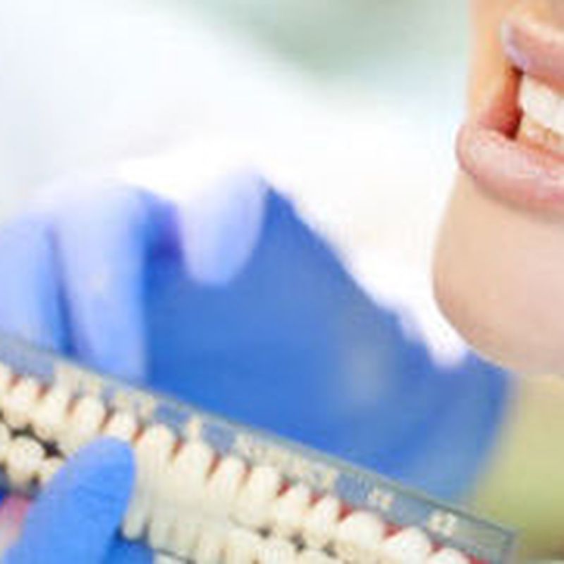 Restauraciones: Tratamientos y tecnología de Clínica Dental Daniel Molina