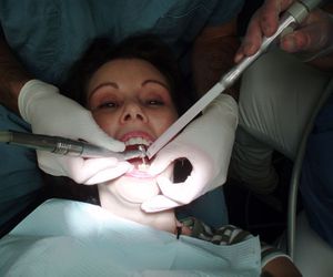 Limpieza dental