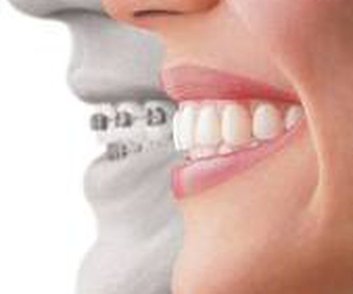 ORTODONCIA: ESPECIALIDADES de Clínica Dental Morey