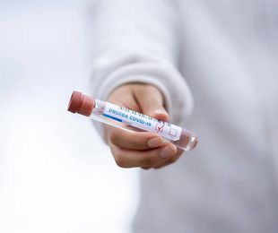 Serología Covid-19