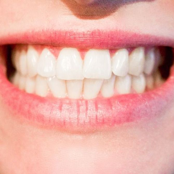 ¿Por qué varía el color de nuestros dientes?