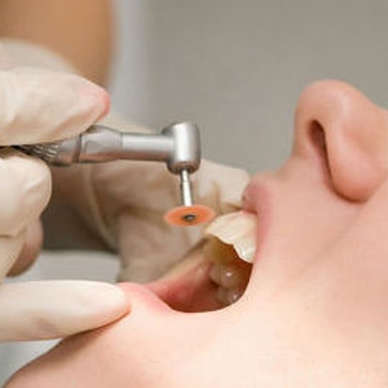Endodoncia : Tratamientos   de Abad Clínica Dental