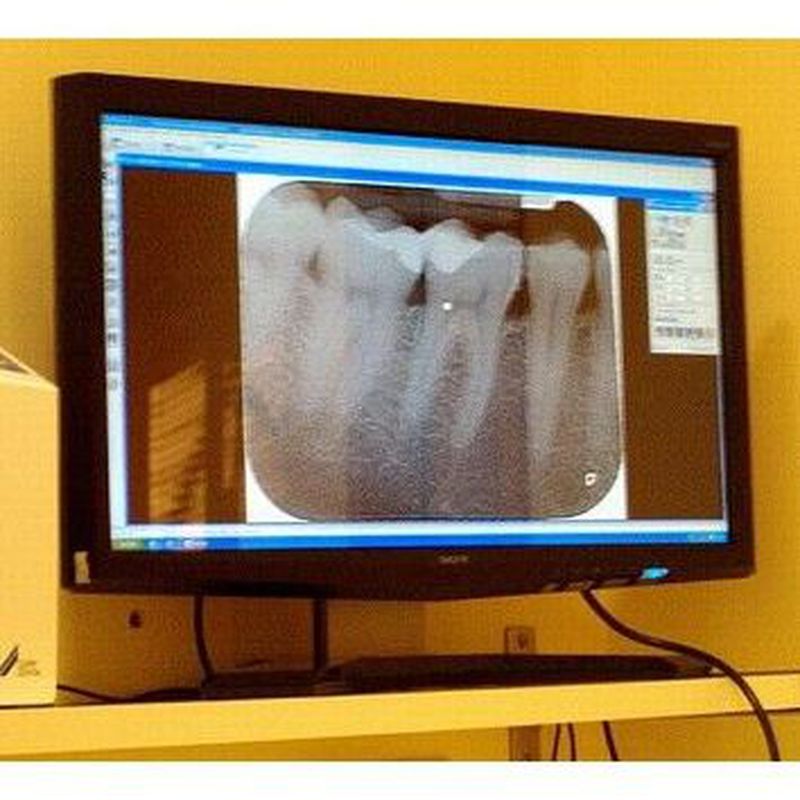 Cirugía e implantes: Tratamientos de Lasierra Fondevila Clínica Dental