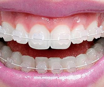 Estética dental: Tratamientos de Dental Valls
