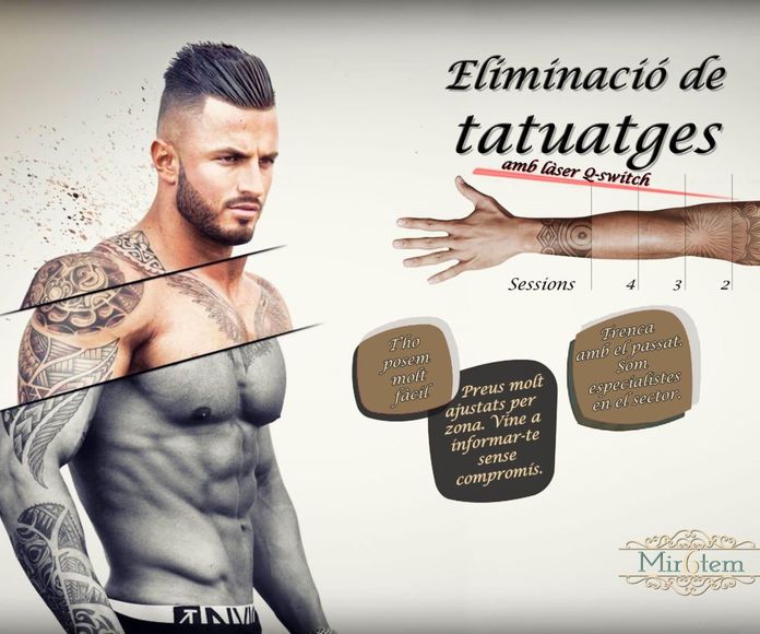 Eliminación de tatuajes: Catálogo de Quiromir6tem