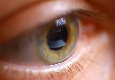 Terapia Visual
