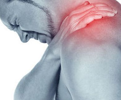 Lesiones frecuentes en Osteopatía: NEURALGIA CERVICOBRAQUIAL "CIÁTICA DE HOMBRO"