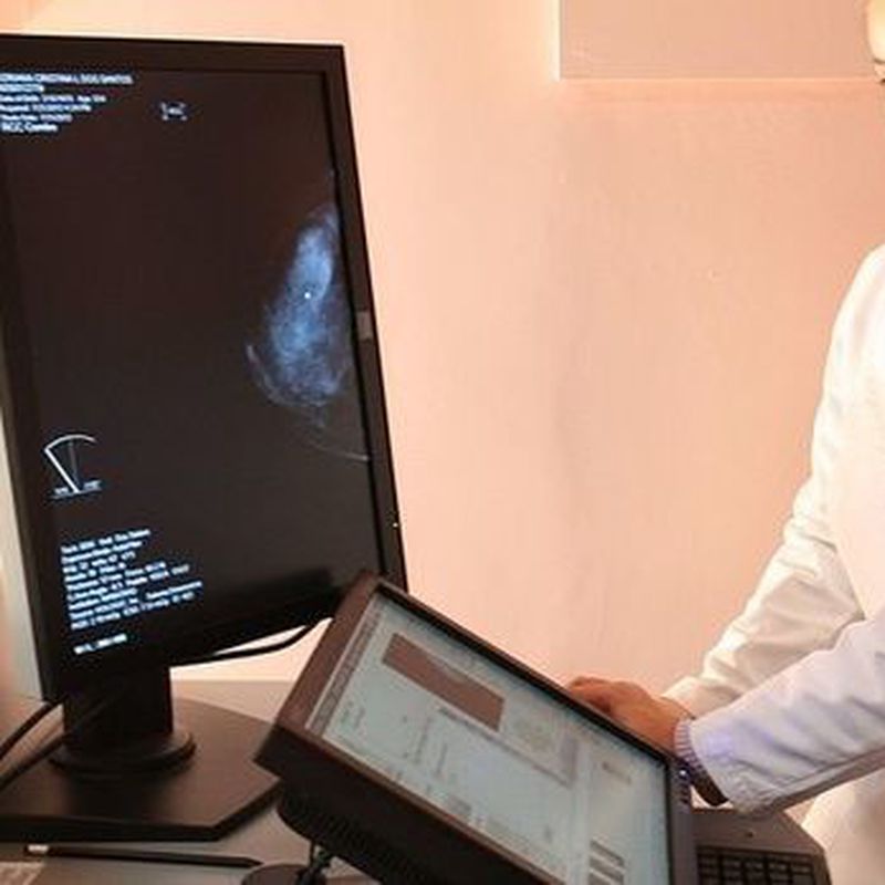 Mamografía: Especialidades de Radiología Arlanzón