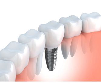 Odontopediatría: Tratamientos dentales de Clínica Dental Dra. Clols