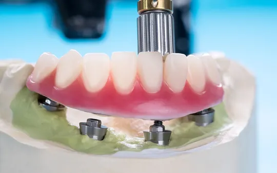 Estética dental en Sagadent Milenium