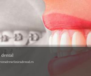 Blanqueamiento dental Led en Jaén: Clínica Dental Villar Estradera