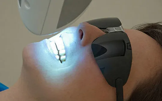 Blanqueamiento dental