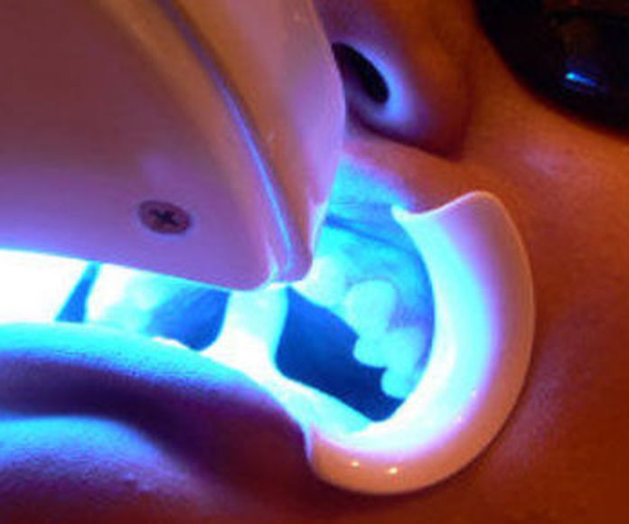 Blanqueamiento dental: Tratamientos de Clínica Dental Fortaña-Giménez